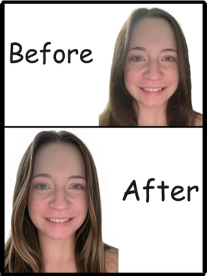 Hair Transformation Package